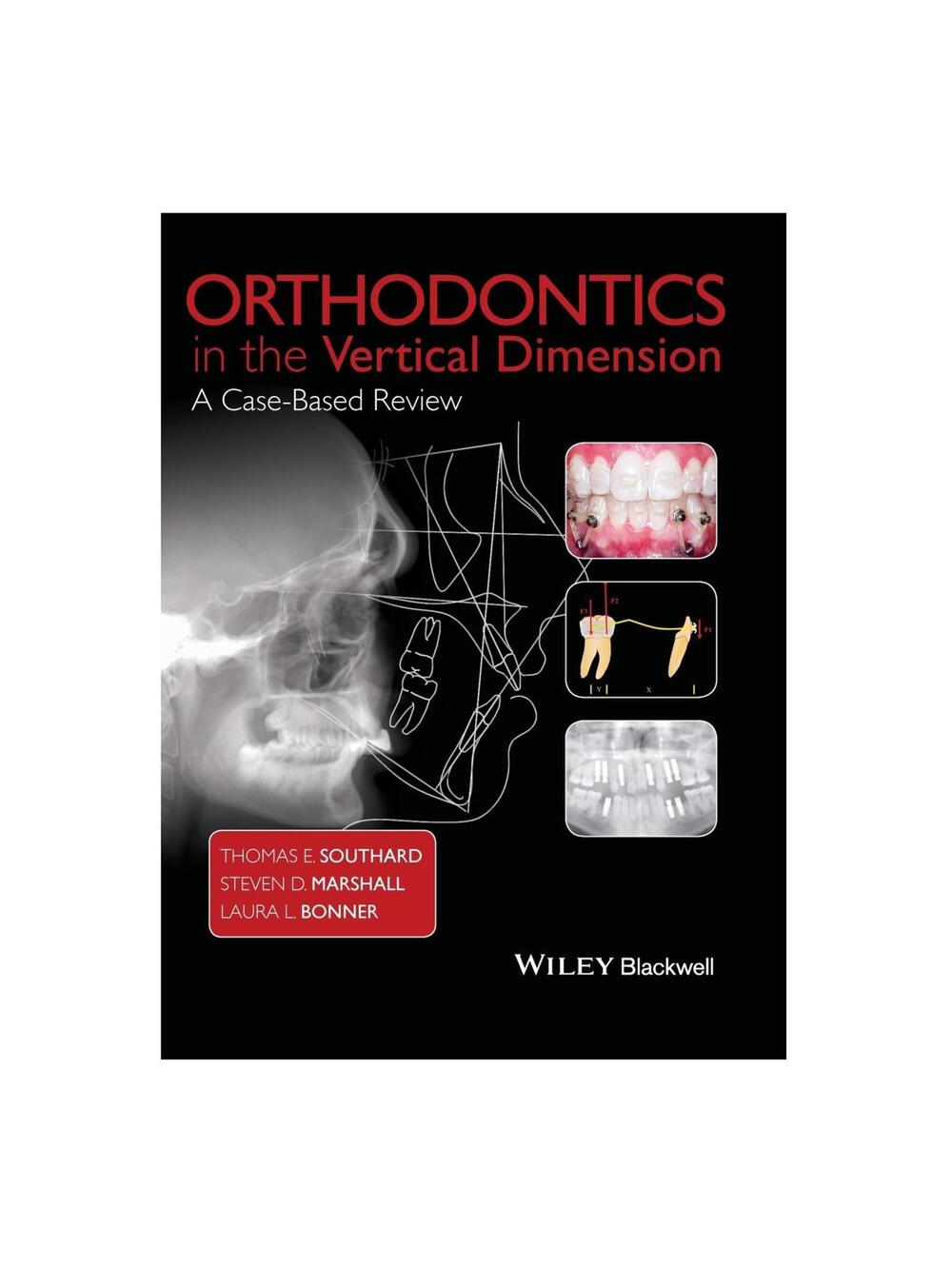 Orthodontics in the Vertical Dimension: A Case-Based Review Hardcover
